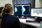 Už 120 nemocnic využívá digitalizaci zdravotnických snímků