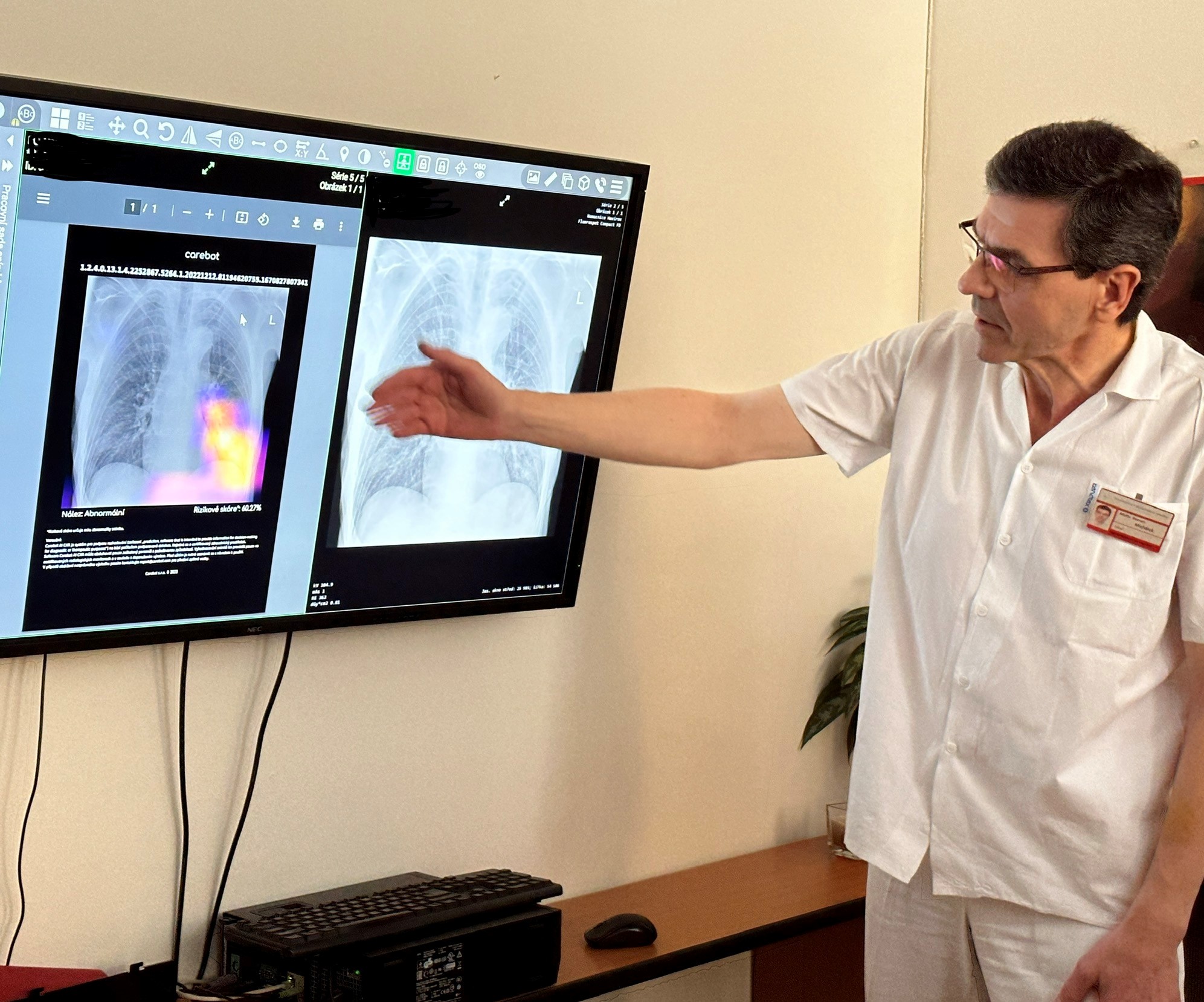 Lékař ukazuje čtení snímků umělou inteligencí