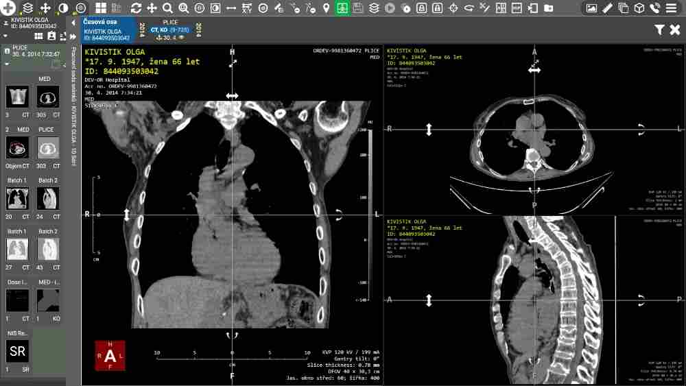 Ukázka prostředí DICOM prohlížeče MARIE WebVision